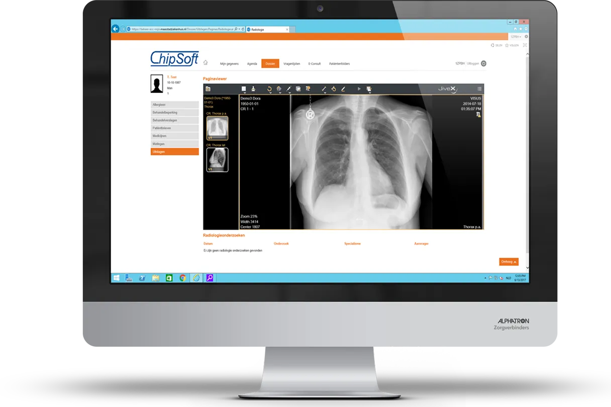 epd-patientenportaal-integratie-viewer-in-hix