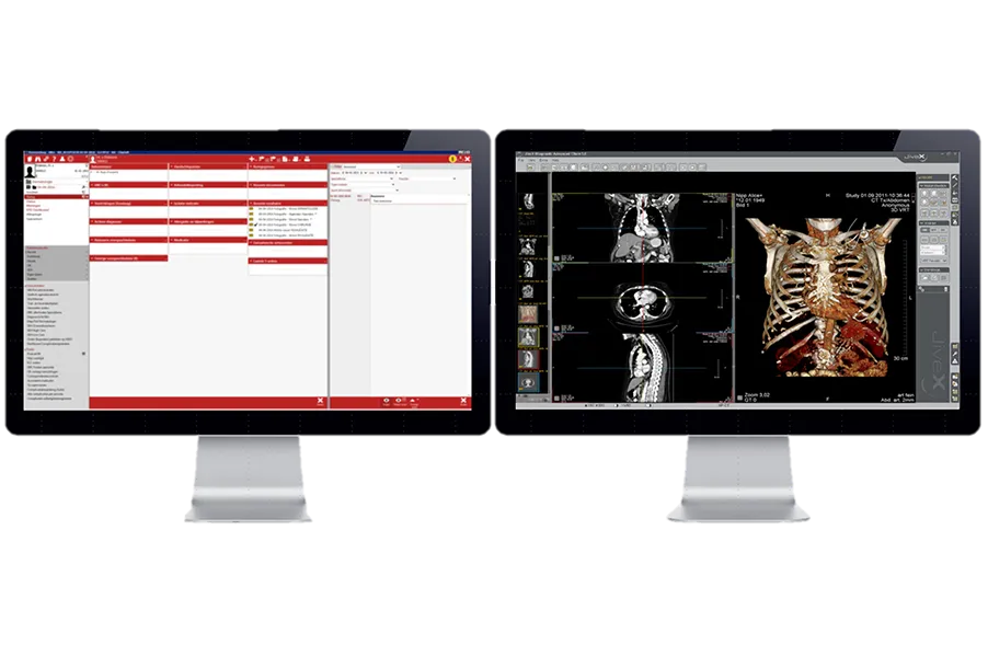 HiX koppeling Chipsoft Alphatron