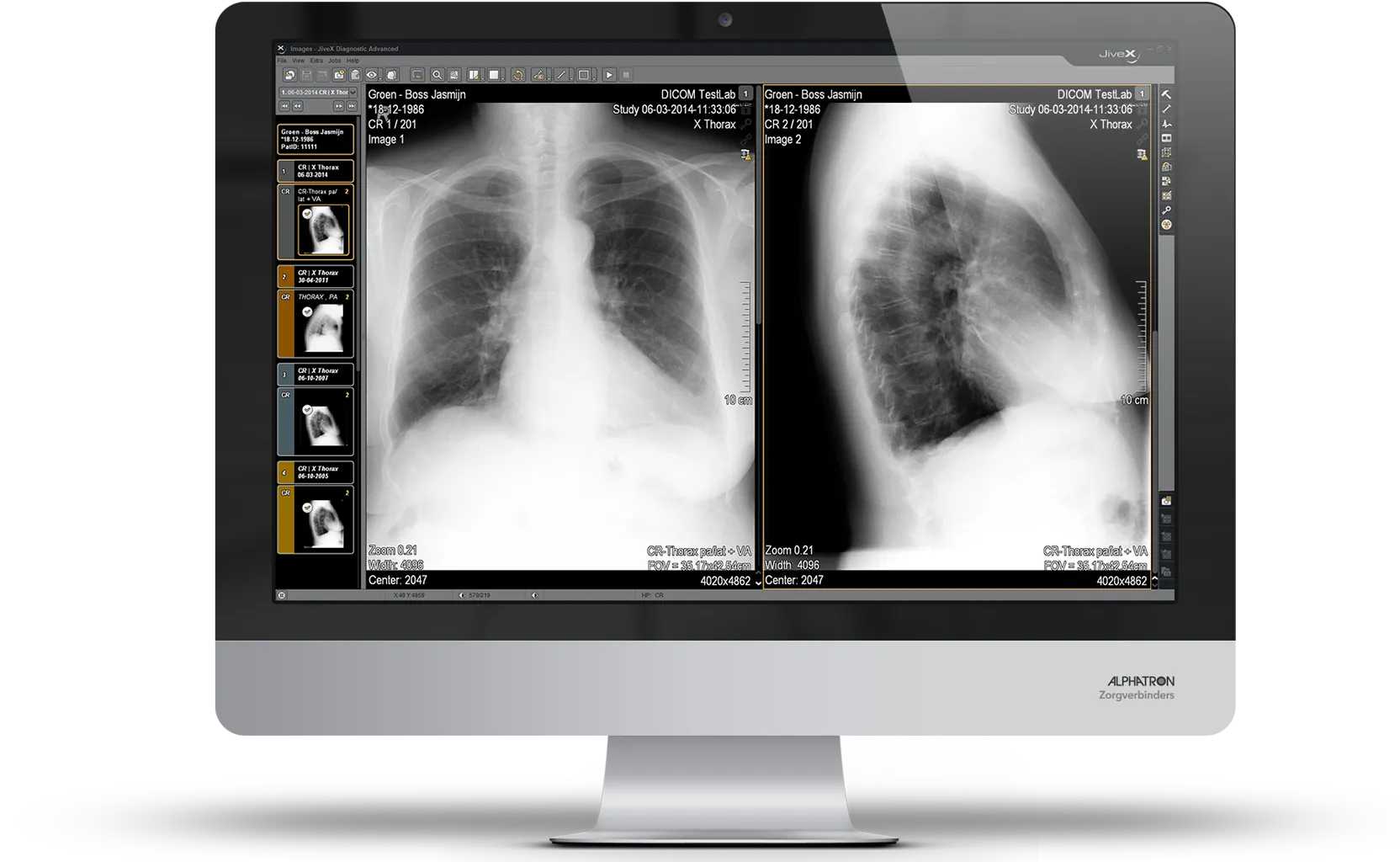 jivex-pacs-alphatron-zorgverbinders-enterprise pacs pacs II