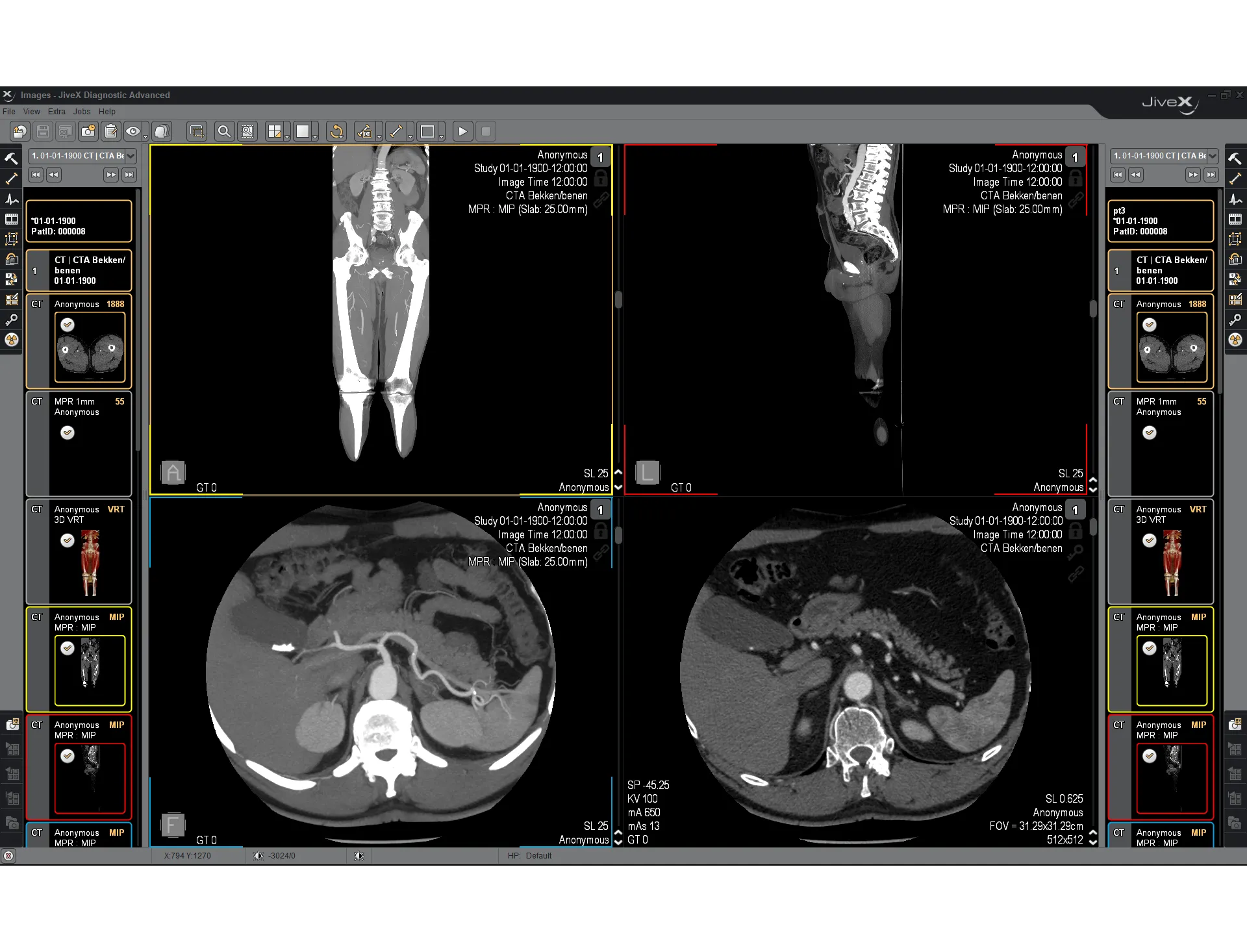 jivex studyman_ct_mpr_viewer-healthcare-content-management