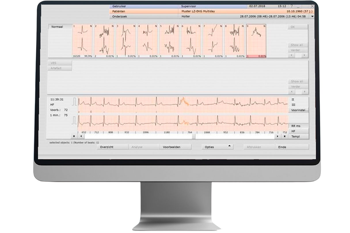 custo-holter-tera-software-alphatron-zorgverbinders